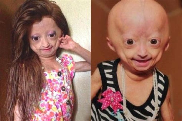 Adalia Rose as a young child with her mother Natalia Pallante. Photo / Getty Images