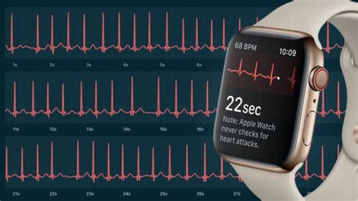 Apple Watch ecg