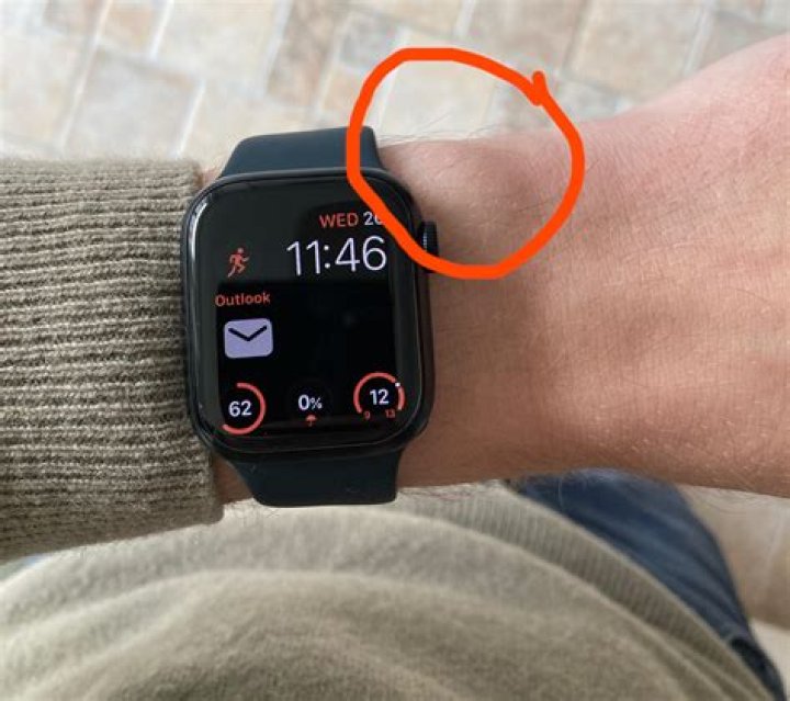 Apple Watch tight loose