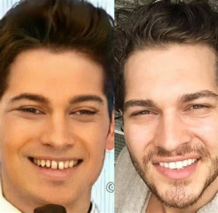 &Ccedil;ağatay Ulusoy and Duygu Sarışın End Their ThreeYear Romance Al Bawaba