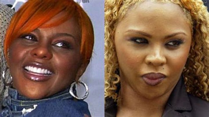 Celebrity plastic surgery disasters Fox News