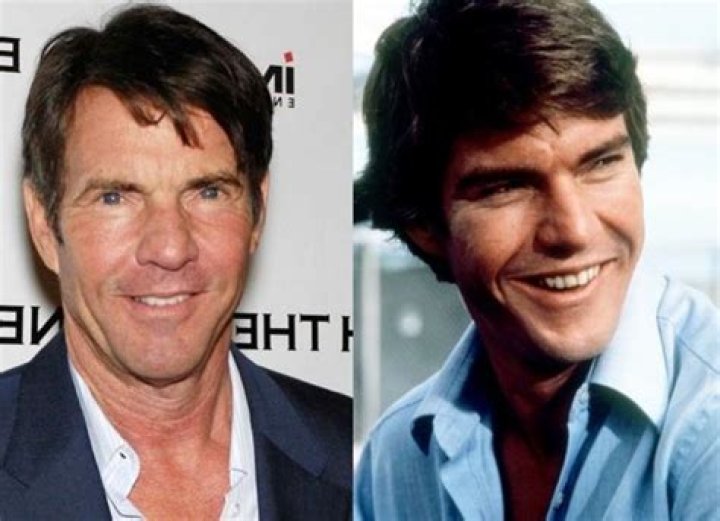 dennis quaid surgery Archives Plastic Surgery Facts