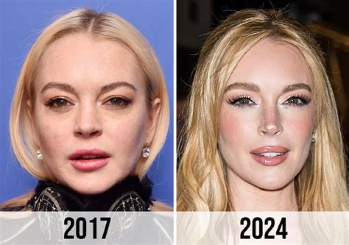 Famous Celebrities 2024 Elnora Lyndsey