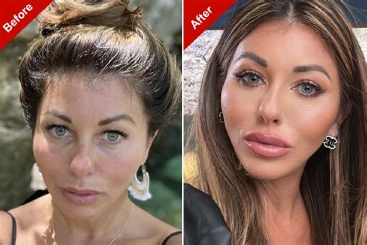 Gloria Plastic Surgery Is The Rumor About Her Plastic Surgery