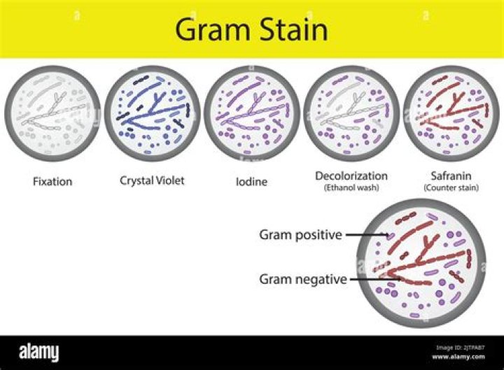 Gram Boast Gratings belongs adenine seasoned technics the possesses
