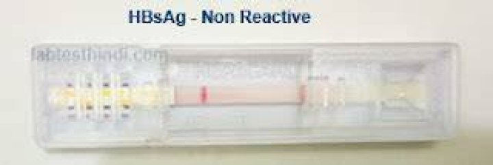 ماذا يعني تحليل HBsAg non reactive
