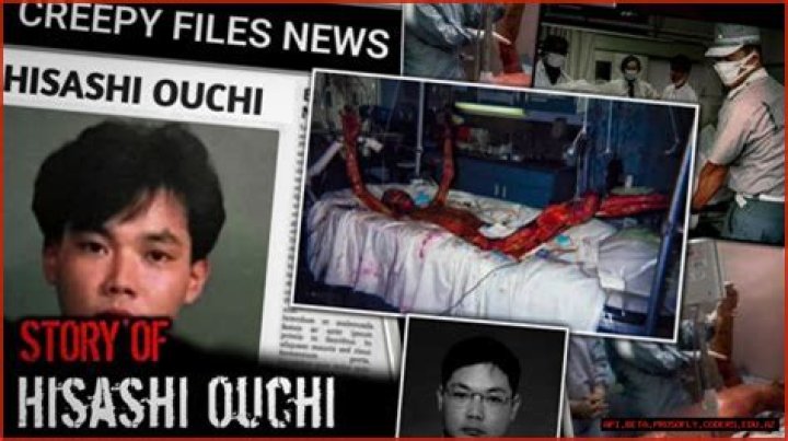 Hisashi Ouchi The Tragic Story Behind The Gore Photos
