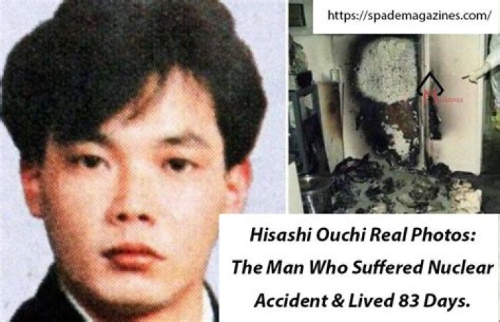 Hisashi Ouchi: The Truth Behind Real Pictures And His Tragic Story