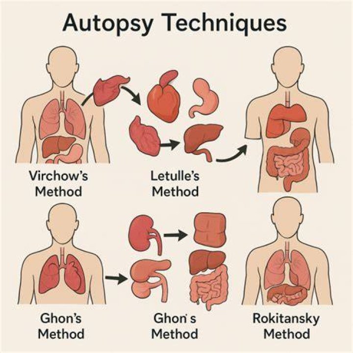 How Did King Von Die? An In-Depth Look At The Autopsy And Its Implications