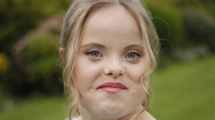 Hugh Grant's Daughter And Down Syndrome: A Journey Of Awareness And Acceptance