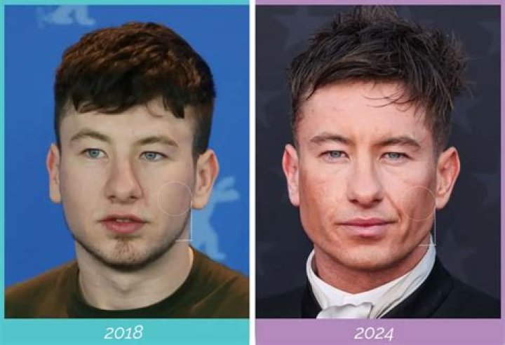Is Barry Keoghan Asian? The Truth About His Ethnicity