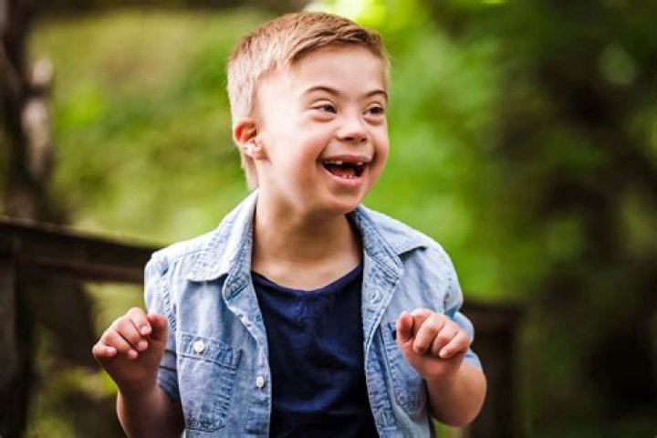 Jason Kelce's Daughter And Down Syndrome: A Journey Of Love And Resilience