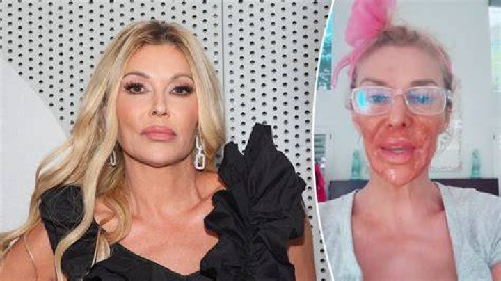 Joanna Krupa And Brandi Glanville: A Deep Dive Into Their Lives And Careers