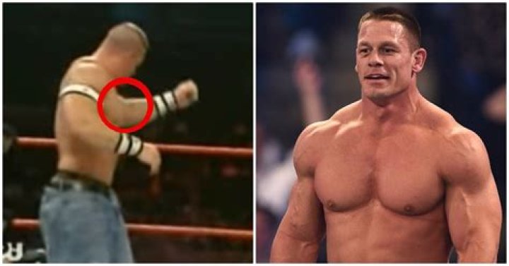 John Cena torn tricep