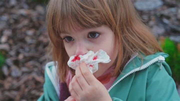 Justine with a bloody nose in Raw