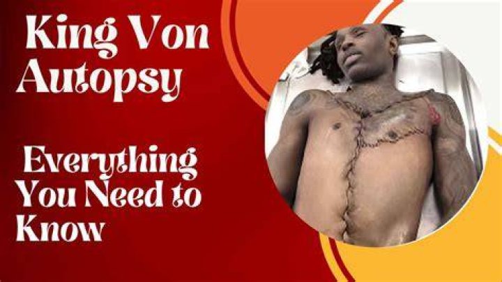 King Von Autopsy Report Details All About the Tragedy Techno Stalking