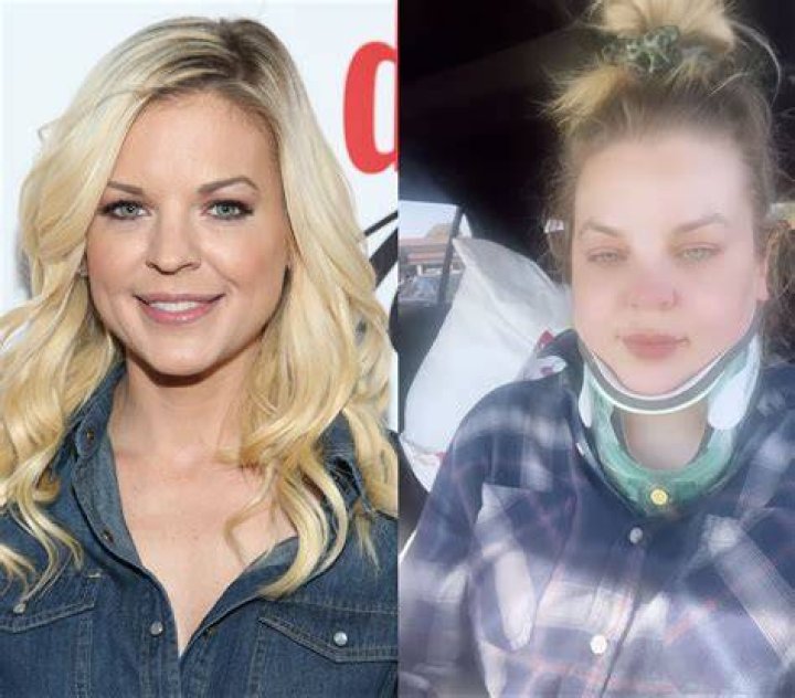 Kirsten Storms Reveals She Had Brain Surgery Details Us Weekly