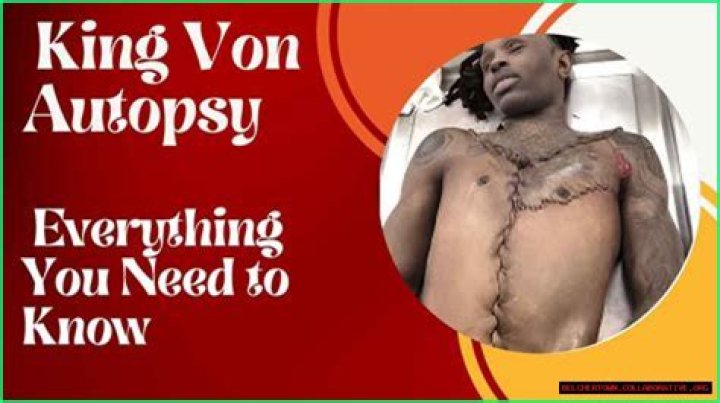 Kong Von Autopsy Unraveling The Mystery Behind The Name
