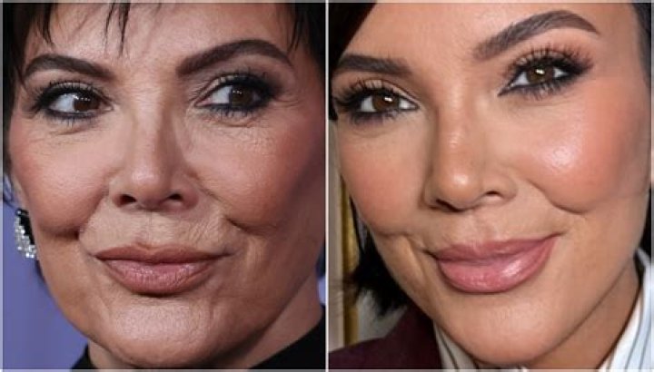 Kris Jenner perfekte plastische Chirurgie f&uuml;r 59 Jahre alte Mutter