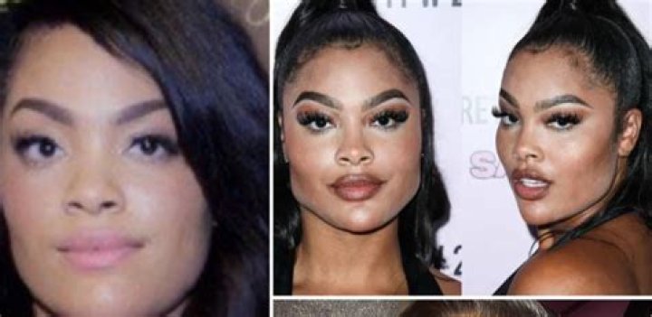 Mehgan James Before & After Plastic Surgery Rumor