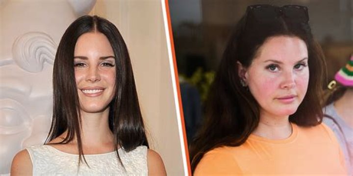 Paparazzi, Lana Rey, Elizabeth Grant, Queen Elizabeth, Normal Body