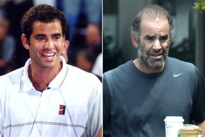 Pete Sampras Retirement Age: A Journey Through His Legendary Career