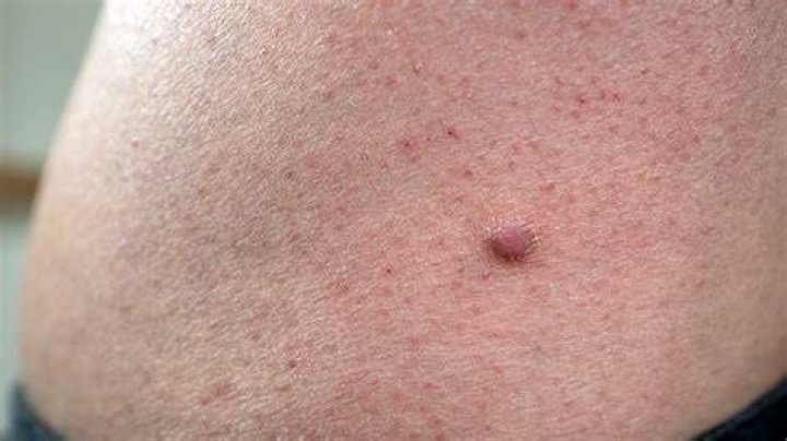 Pin on Athl&egrave;tes Sexy