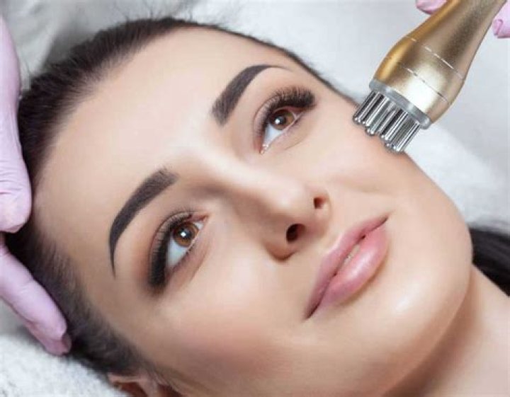 Radio Frequency Skin Tightening Near Me, RF Skin Tightening Near Me