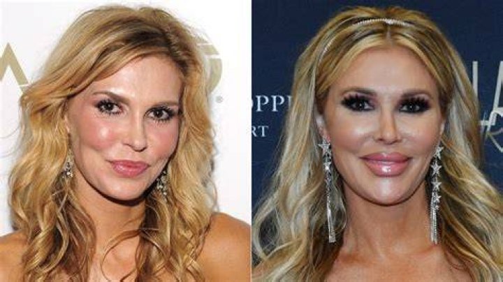Real Housewives Stars Who Are Almost Unrecognizable Now