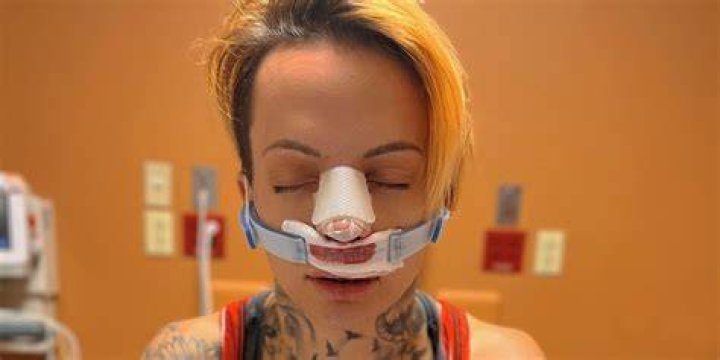 Ruby Soho knee injury 