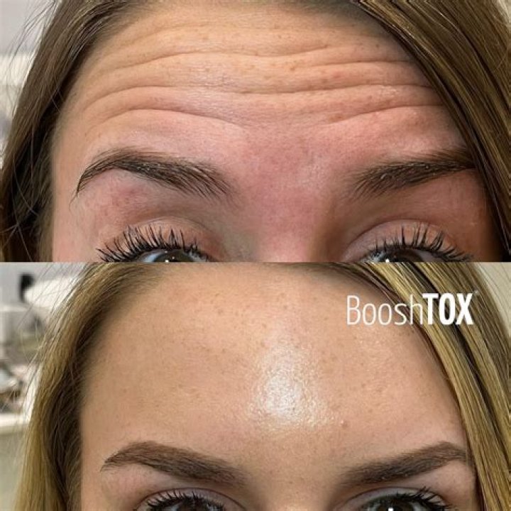 Sarah Jessica Parker's Stance On Botox