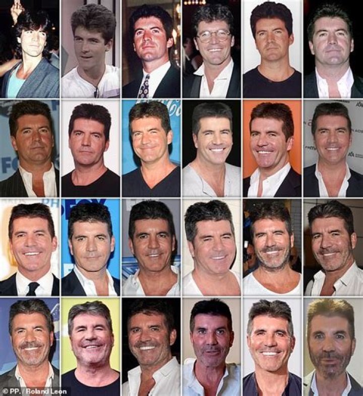 Simon Cowell Now Music Mogul Unrecognizable After Removing THIS