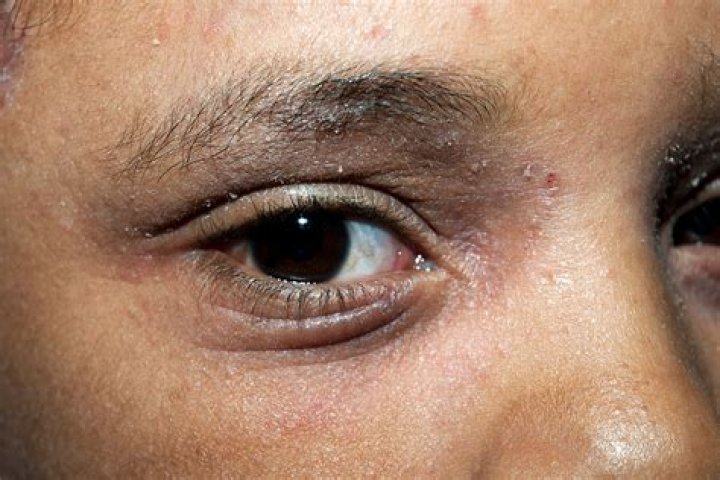 The angry eyes come out