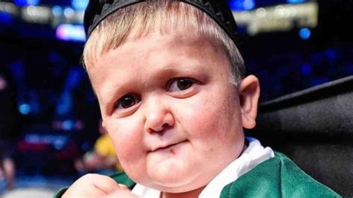 The Theory About Hasbulla Magomedov's Rare Condition