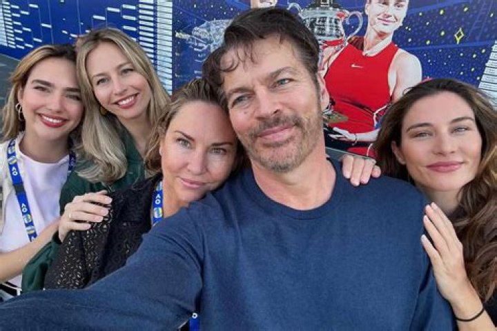 Understanding Harry Connick Jr's Face Scar: A Deep Dive
