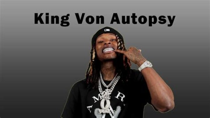 Understanding The King Von Autopsy Picture: A Deep Dive Into The Life And Legacy Of A Hip-Hop Icon
