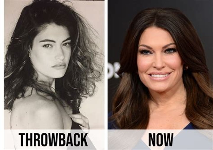 What Happened To Kimberly Guilfoyle's Face?