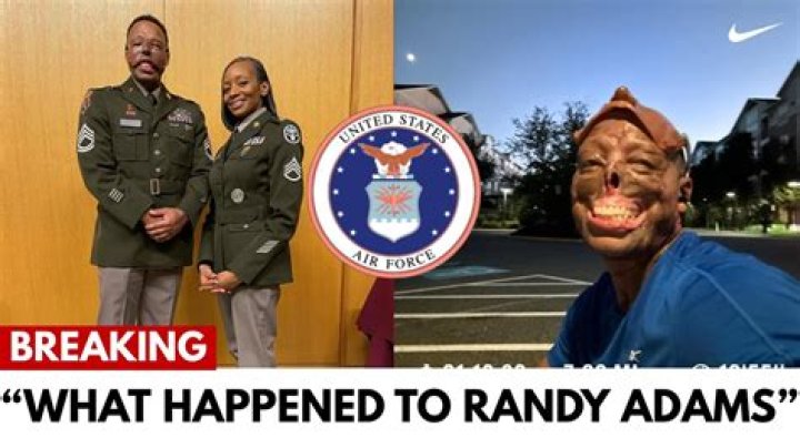 What Happened to Randy Adams Face? Randy Adams Face Burn Before and After