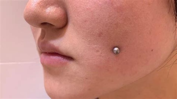 What You Should Know Before You Get Your Cheeks Pierced
