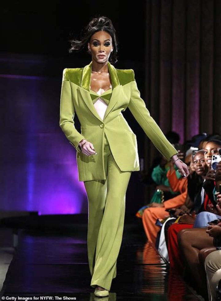 Winnie Harlow LOreal Runway Show in Paris 19 GotCeleb
